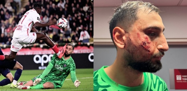 Monaco-PSG: Singo victime d'insultes racistes en ligne après sa semelle au visage de Donnarumma