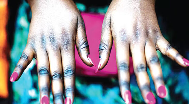 Top 7 des pays africains où la population blanchit le plus la peau