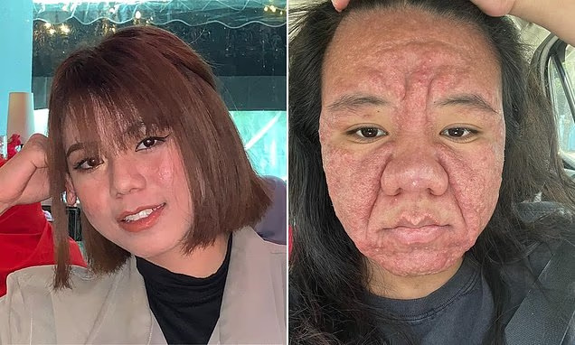 Une femme révèle comment les hormones de grossesse ont rendu son visage méconnaissable