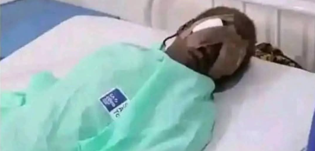 Un adolescent arra.che les yeux de sa sœur de 7 ans pour un rituel d’argent