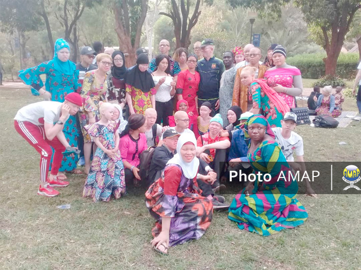 Personnes atteintes d’albinisme : Une vie qui rime avec stigmatisation et discrimination