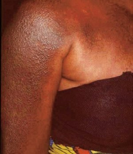 Produits éclaircissants: Les Africaines ont-elles honte de leur teint ?