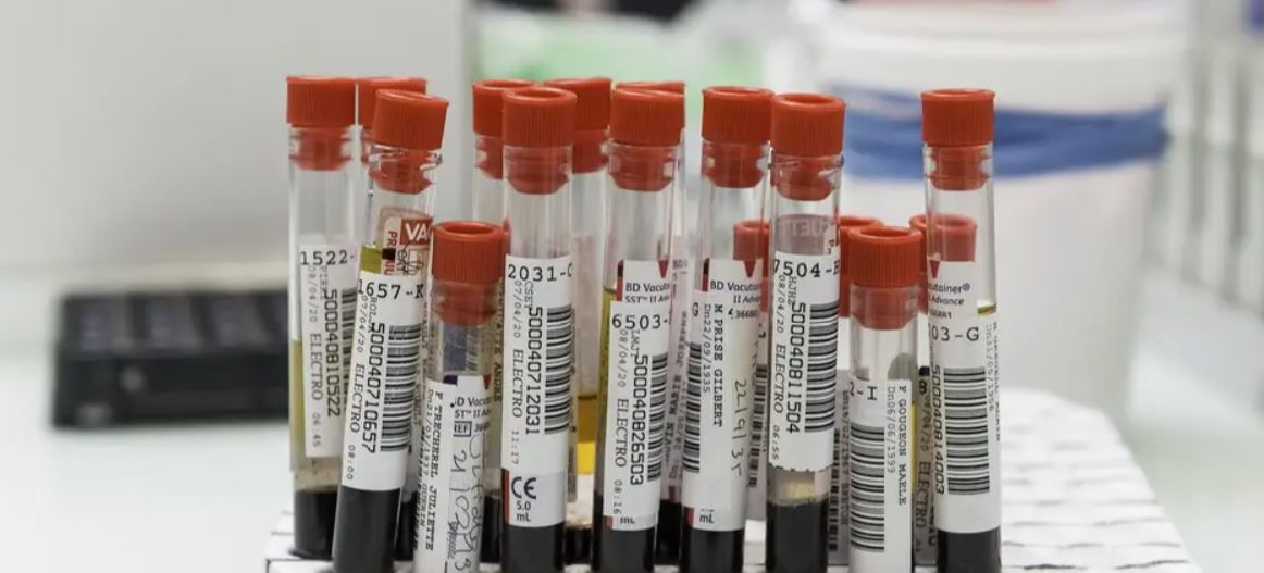 Chronique : COVID-19, le devoir de vigilance